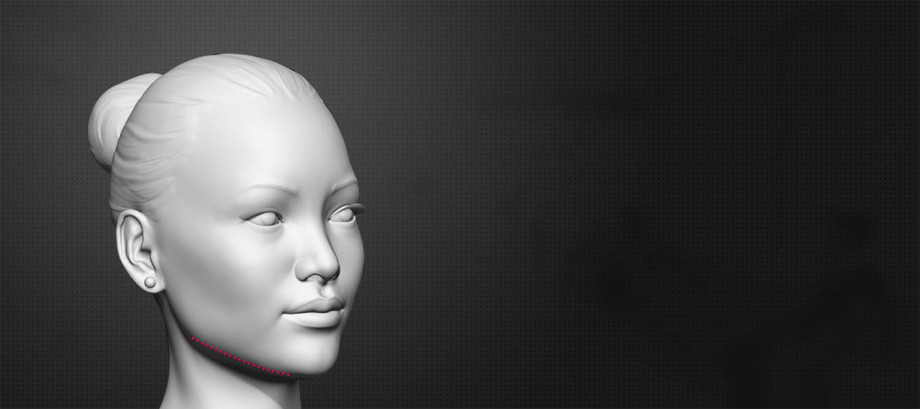 jawlinesurgeryinindia.jpg