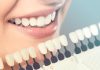 Some Secrets About Teeth Whitening San Diego teeth whitening san diego