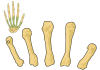 Top natural remedies of Arthritis