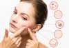 Acne Treatments Recommended by Dermatologists Dermatologist in Islamabad