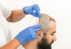 How To Get Natural Hair Growth From Hair Transplantation? How To Get Natural Hair Growth From Hair Transplantation
