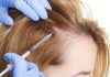 HAIR RESTORATION AND HAIR TRANSPLANTATION HAIR TRANSPLANTATION