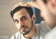 Dandruff – Causes, how to treat it and more dandruff
