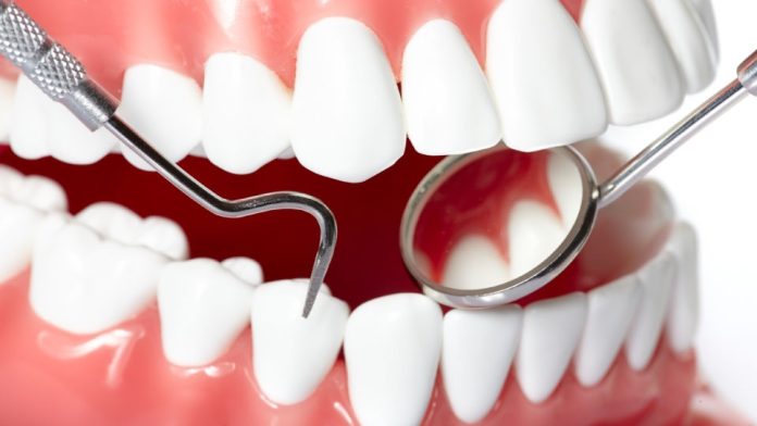 What is The Procedure of Dental Veneers in Berwick What is The Procedure of Dental Veneers in Berwick