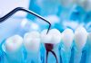 All You Need To Know About Root Canal Treatment root canal