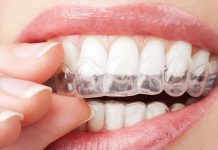 How Much Do Removable Retainers Cost?