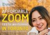 What You Need To Know About Zoom Whitening? Zoom Whitening