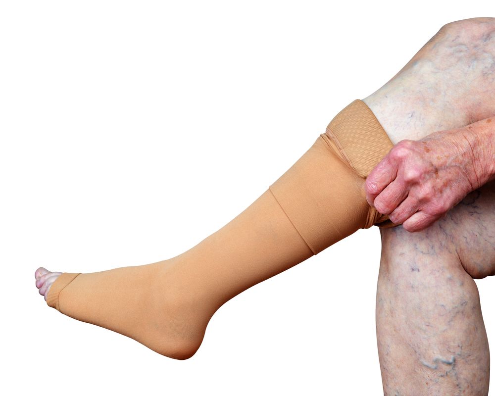Why Nurses and Sportsmen Need Compression Stockings, Knee Support, and Customised Insoles? - Posting Station