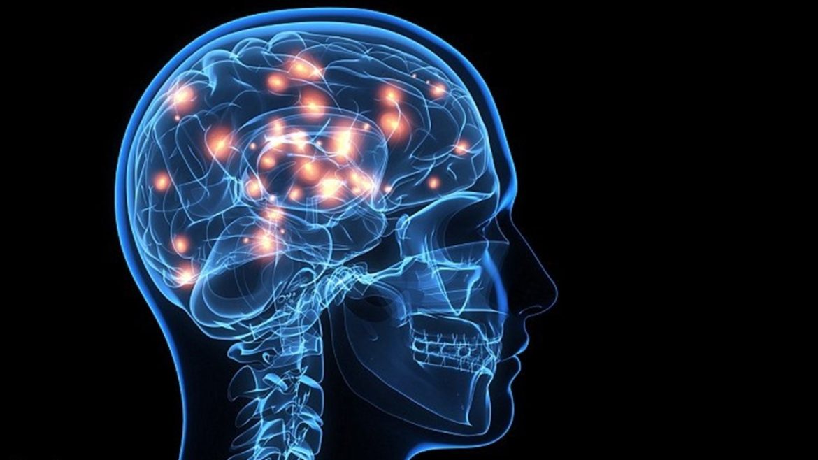 Advantages Of Buying Cheap Nootropil 800 Mg